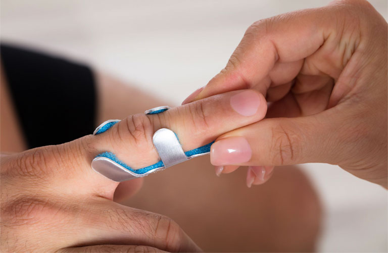5 bài tập vật lý trị liệu ngón tay cò súng giảm đau, phục hồi nhanh 1 Có thể chữa ngón tay bị cò súng bằng vật lý trị liệu không?