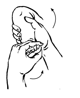 Phục hồi chức năng dựa vào cộng đồng: bàn chân khoèo bẩm sinh Phục hồi chức năng dựa vào cộng đồng: bàn chân khoèo bẩm sinhPhục hồi chức năng dựa vào cộng đồng: bàn chân khoèo bẩm sinh