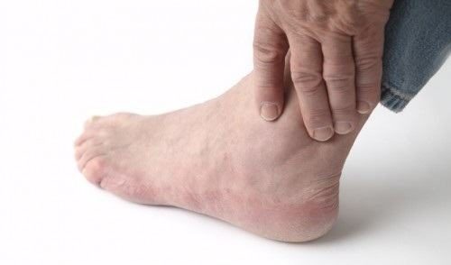 Mỏi cổ chân xảy ra do nhiều nguyên nhân.