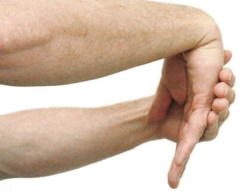 Đau sưng khớp cổ tay CHỚ COI THƯỜNG 2 căn bệnh nguy hiểm này