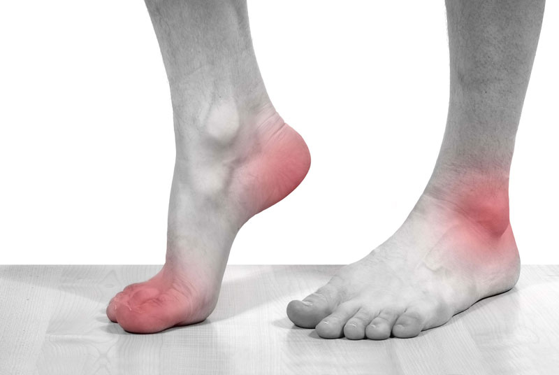 3 cách điều trị gout hiệu quả bạn nên biết 2 Nguyên nhân gây ra bệnh Gout