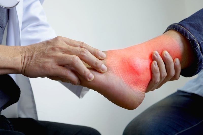 3 cách điều trị gout hiệu quả bạn nên biết 3 Đối tượng dễ mắc bệnh Gout