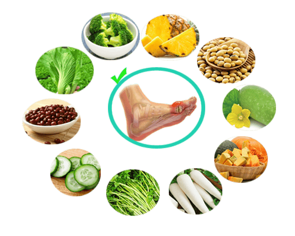 3 cách điều trị gout hiệu quả bạn nên biết 4 Điều chỉnh chế độ dinh dưỡng chữa gout