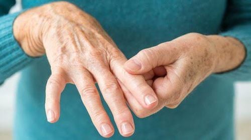 Cách điều trị viêm khớp dạng thấp an toàn, không biến chứng 2 Những ai dễ mắc viêm khớp dạng thấp?