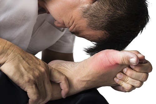 Viêm khớp do bệnh gút cũng là một nguyên nhân gây đau khớp đột ngột.