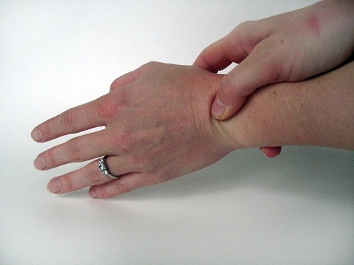 Hai loại viêm khớp thường ảnh hưởng đến các ngón cái và cổ tay là viêm xương khớp và viêm khớp dạng thấp.