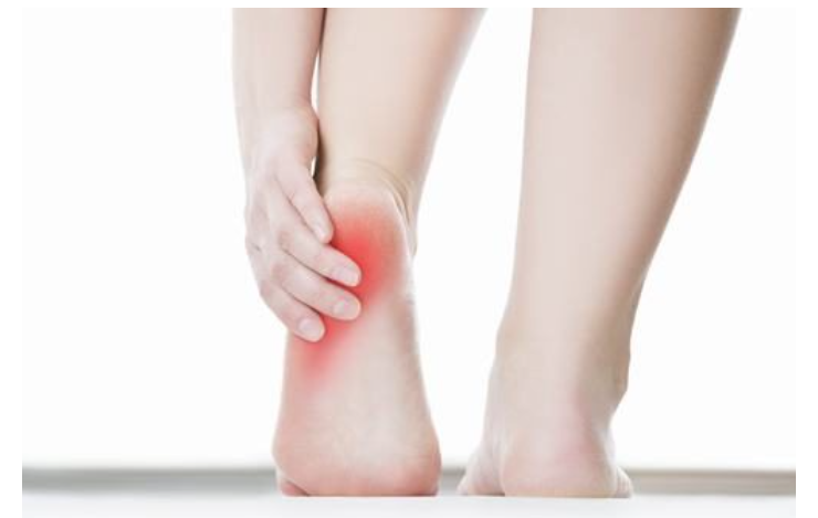 Viêm cơ chân có nguy hiểm không? Nguyên nhân và cách phòng ngừa 3 Viêm cơ bàn chân